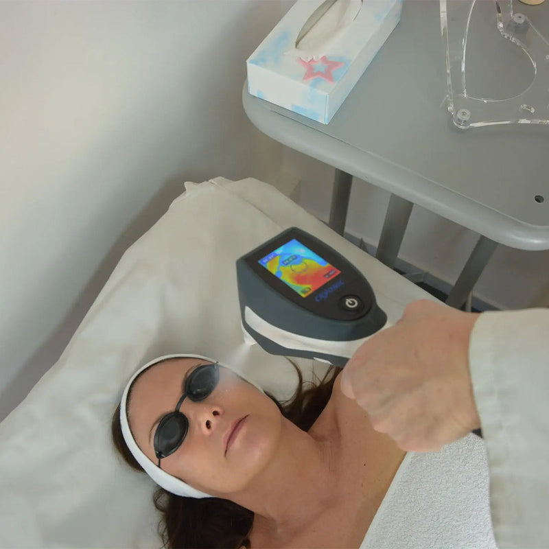 Load image into Gallery viewer, Cryoscreen®